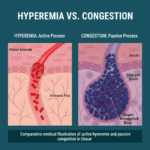 Comparative medical illustration of active hyperemia and passive congestion in tissue.